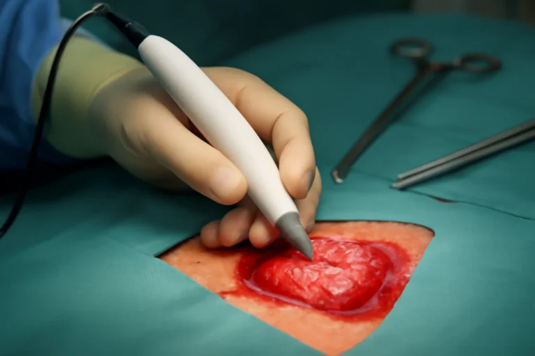 Caneta que detecta tumor em segundos, invenção da química Lívia Eberlin promete cirurgias mais precisas após mais de 400 testes e avaliação no Brasil